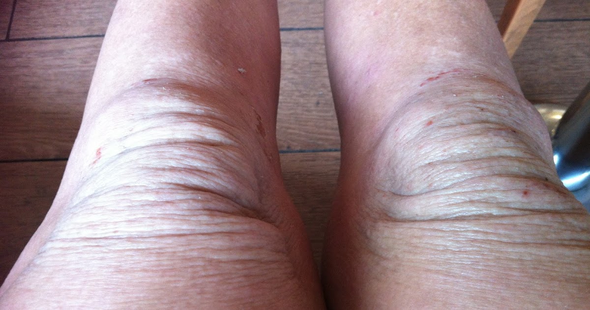 Marks of Life Elephant skin!